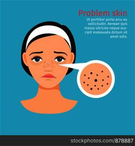 Woman face problem skin with black dots, vector illustration. Woman face problem black dots