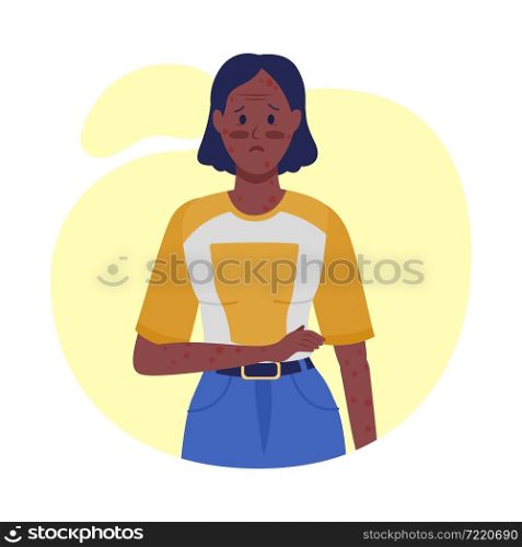 Woman with itchy skin semi flat color vector character. Posing figure. Full body person on white. Post covid syndrome isolated modern cartoon style illustration for graphic design and animation. Woman with itchy skin semi flat color vector character