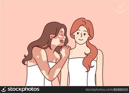 Woman with vitiligo syndrome hugs friend in bath towel and laughs enjoying fellowship and tolerance. Two cheerful girlfriends with freckles on skin or spots associated with vitiligo pigmentation . Woman with vitiligo syndrome hugs friend in bath towel and laughs enjoying fellowship and tolerance