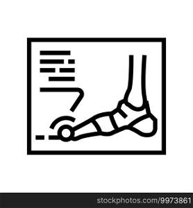x-ray radiograph of foot gout diesase line icon vector. x-ray radiograph of foot gout diesase sign. isolated contour symbol black illustration. x-ray radiograph of foot gout diesase line icon vector illustration