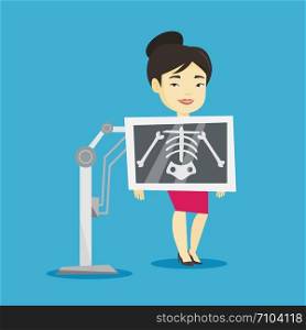 Young asian woman during chest x ray procedure. Smiling woman with x ray screen showing her skeleton. Happy patient visiting roentgenologist. Vector flat design illustration. Square layout.. Patient during x ray procedure vector illustration