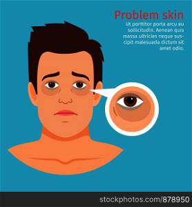 Young man face problem skin with black circles under the eyes, vector illustration. Young man face problem black circles